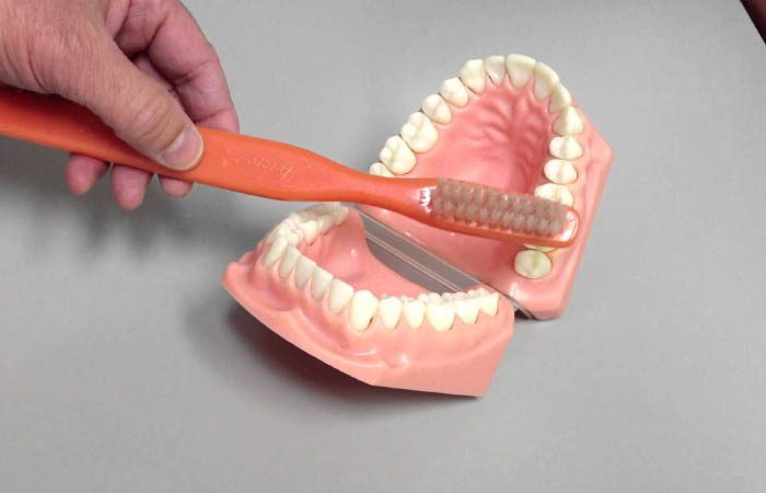 cara menghilangkan plak pada gigi